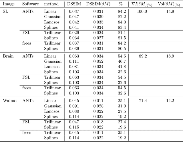Figure 4 for Oversampling errors in multimodal medical imaging are due to the Gibbs effect
