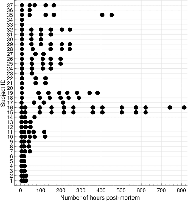 Figure 1 for Iris Recognition After Death