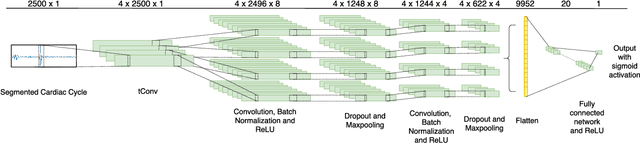 Figure 3 for Learning Front-end Filter-bank Parameters using Convolutional Neural Networks for Abnormal Heart Sound Detection