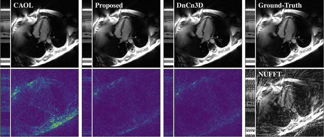 Figure 2 for Convolutional Analysis Operator Learning by End-To-End Training of Iterative Neural Networks