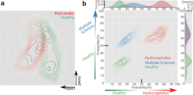 Figure 3 for uBAM: Unsupervised Behavior Analysis and Magnification using Deep Learning