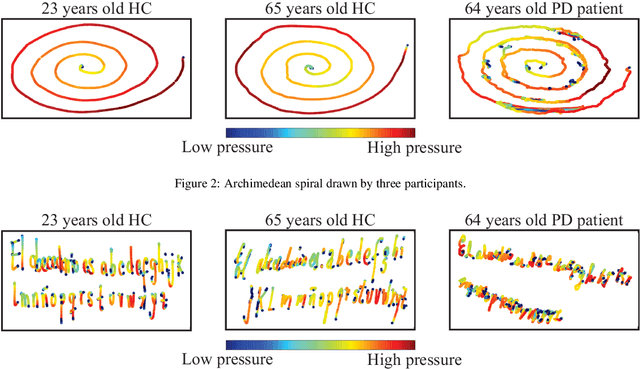 Figure 3 for Analysis and Evaluation of Handwriting in Patients with Parkinson's Disease Using kinematic, Geometrical, and Non-linear Features