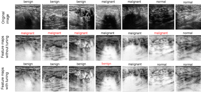 Figure 3 for MetaLR: Layer-wise Learning Rate based on Meta-Learning for Adaptively Fine-tuning Medical Pre-trained Models
