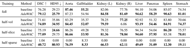 Figure 2 for AdaWAC: Adaptively Weighted Augmentation Consistency Regularization for Volumetric Medical Image Segmentation