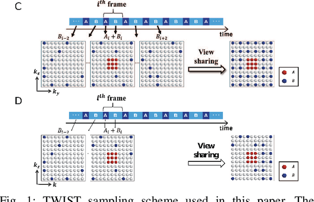 Figure 1 for Unsupervised Deep Learning for MR Angiography with Flexible Temporal Resolution