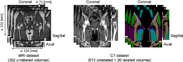 Figure 1 for Cross-modality image synthesis from unpaired data using CycleGAN: Effects of gradient consistency loss and training data size