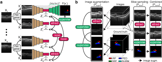 Figure 1 for Unsupervised Domain Adaptation with Contrastive Learning for OCT Segmentation