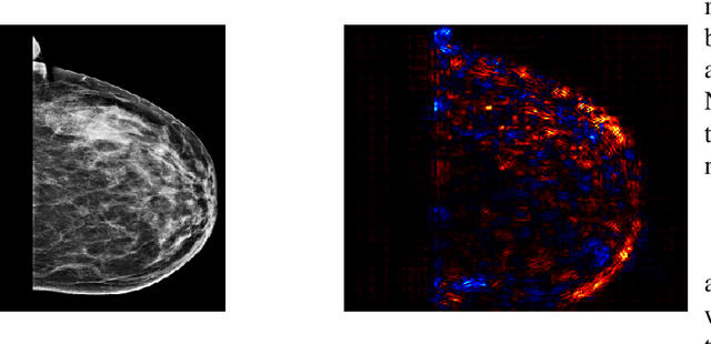 Figure 4 for An XAI Approach to Deep Learning Models in the Detection of Ductal Carcinoma in Situ