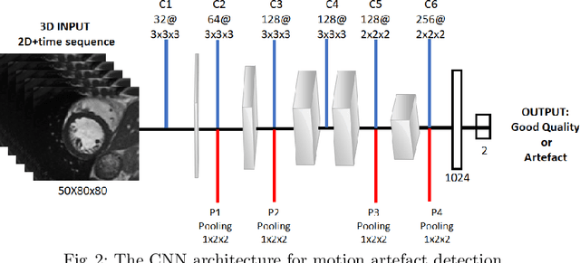 Figure 3 for Deep Learning using K-space Based Data Augmentation for Automated Cardiac MR Motion Artefact Detection