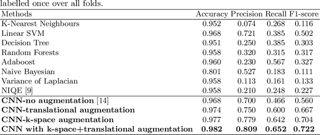 Figure 2 for Deep Learning using K-space Based Data Augmentation for Automated Cardiac MR Motion Artefact Detection