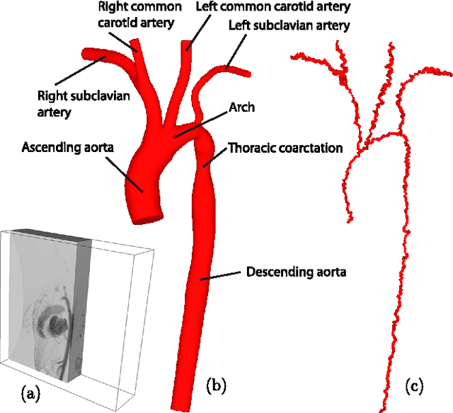 Figure 4 for Topology preserving thinning for cell complexes