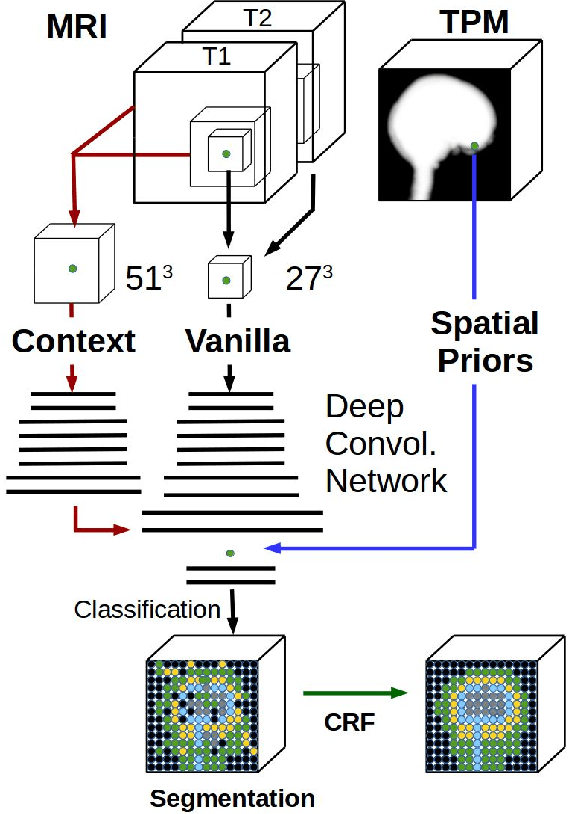 Figure 1 for Tissue segmentation with deep 3D networks and spatial priors