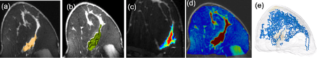 Figure 1 for TopoTxR: A Topological Biomarker for Predicting Treatment Response in Breast Cancer
