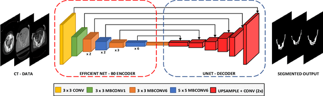 Figure 3 for Boosting Segmentation Performance across datasets using histogram specification with application to pelvic bone segmentation