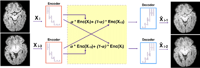 Figure 1 for Slice estimation in diffusion MRI of neonatal and fetal brains in image and spherical harmonics domains using autoencoders