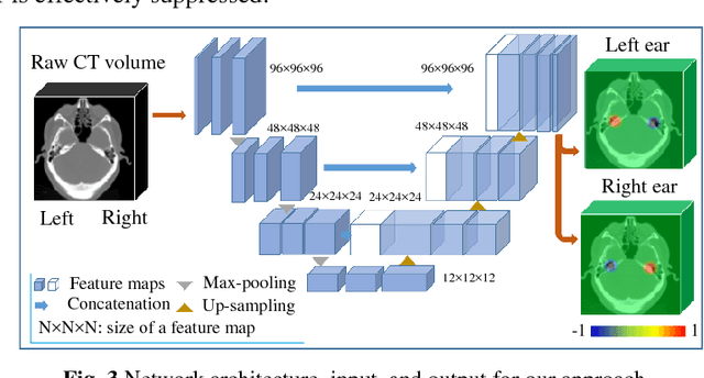 Figure 3 for Accurate Detection of Inner Ears in Head CTs Using a Deep Volume-to-Volume Regression Network with False Positive Suppression and a Shape-Based Constraint