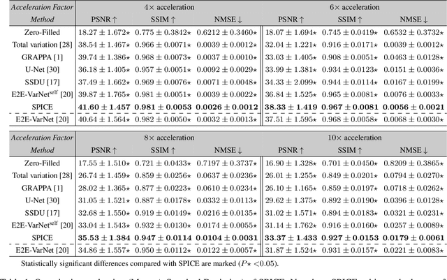 Figure 2 for SPICE: Self-Supervised Learning for MRI with Automatic Coil Sensitivity Estimation