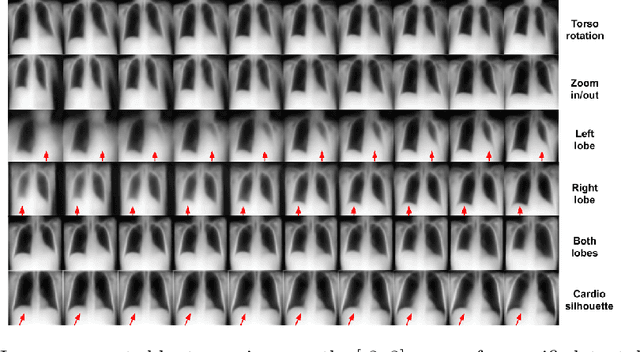 Figure 3 for Semi-Supervised Learning by Disentangling and Self-Ensembling Over Stochastic Latent Space