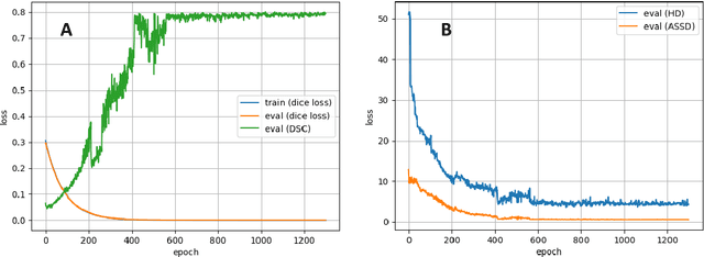 Figure 3 for Convolutional neural network based deep-learning architecture for intraprostatic tumour contouring on PSMA PET images in patients with primary prostate cancer
