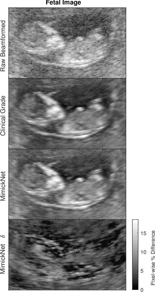 Figure 1 for MimickNet, Matching Clinical Post-Processing Under Realistic Black-Box Constraints