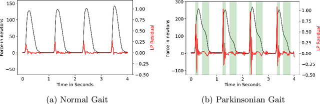 Figure 1 for Linear Prediction Residual for Efficient Diagnosis of Parkinson's Disease from Gait