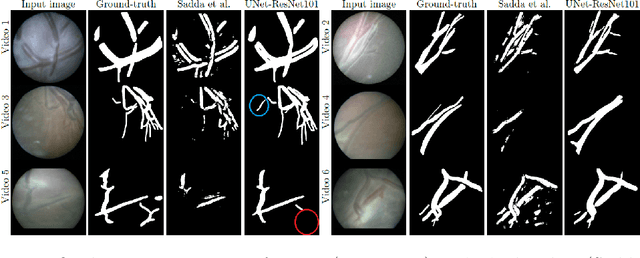 Figure 3 for Deep Placental Vessel Segmentation for Fetoscopic Mosaicking