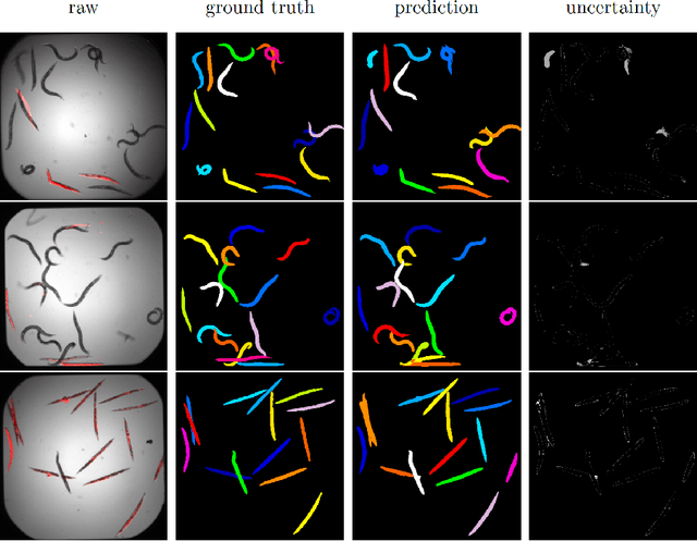 Figure 2 for Probabilistic Deep Learning for Instance Segmentation