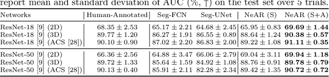 Figure 3 for Neural Annotation Refinement: Development of a New 3D Dataset for Adrenal Gland Analysis