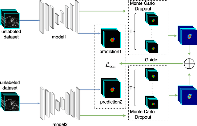 Figure 3 for Uncertainty-Aware Deep Co-training for Semi-supervised Medical Image Segmentation