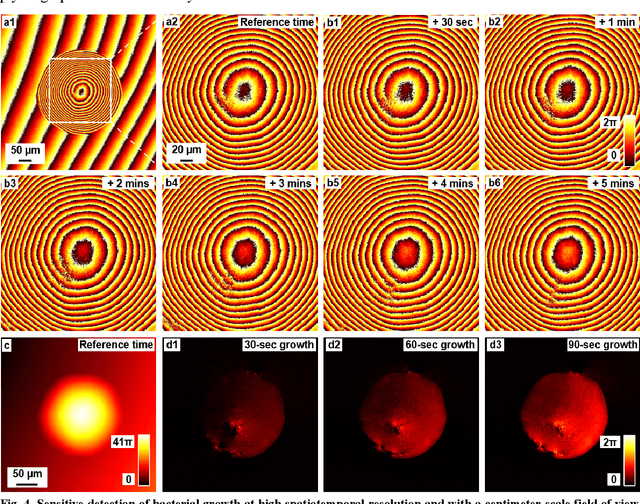 Figure 4 for Ptychographic sensor for large-scale lensless microbial monitoring with high spatiotemporal resolution
