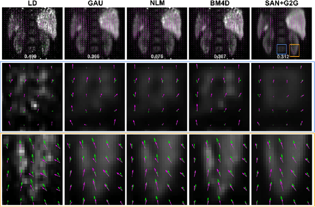 Figure 4 for Simultaneous Denoising and Motion Estimation for Low-dose Gated PET using a Siamese Adversarial Network with Gate-to-Gate Consistency Learning