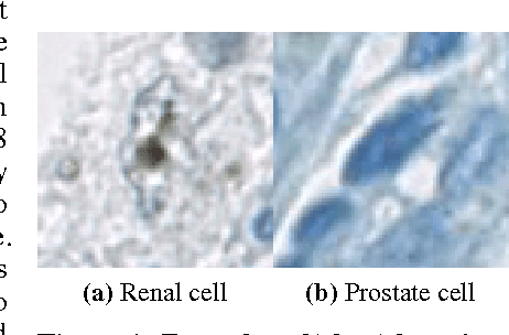 Figure 1 for Multi-Organ Cancer Classification and Survival Analysis