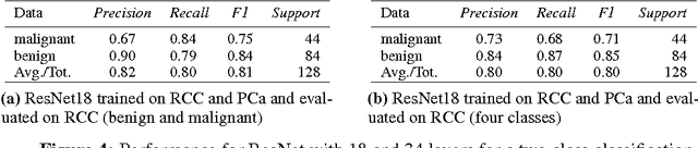 Figure 4 for Multi-Organ Cancer Classification and Survival Analysis