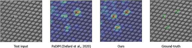 Figure 1 for Semi-orthogonal Embedding for Efficient Unsupervised Anomaly Segmentation
