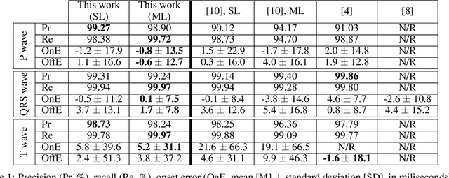 Figure 2 for Generalizing electrocardiogram delineation: training convolutional neural networks with synthetic data augmentation