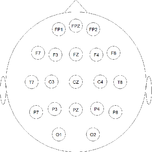 Figure 1 for EEG Signal Processing using Wavelets for Accurate Seizure Detection through Cost Sensitive Data Mining