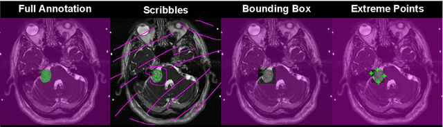 Figure 1 for Inter Extreme Points Geodesics for Weakly Supervised Segmentation