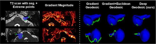 Figure 3 for Inter Extreme Points Geodesics for Weakly Supervised Segmentation