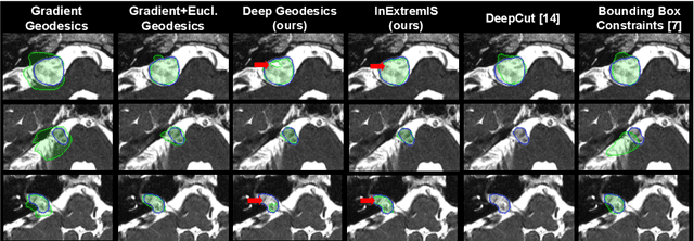 Figure 4 for Inter Extreme Points Geodesics for Weakly Supervised Segmentation