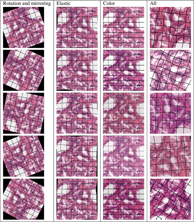 Figure 4 for Segmenting Potentially Cancerous Areas in Prostate Biopsies using Semi-Automatically Annotated Data
