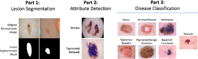 Figure 1 for Skin Lesion Analysis Toward Melanoma Detection 2018: A Challenge Hosted by the International Skin Imaging Collaboration (ISIC)