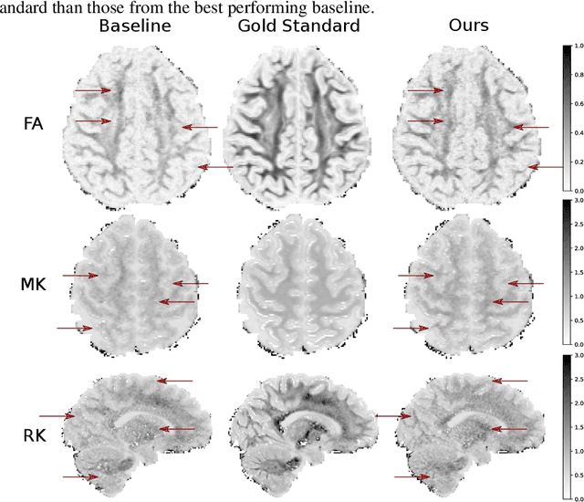 Figure 4 for An Experiment Design Paradigm using Joint Feature Selection and Task Optimization