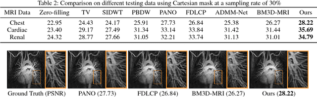 Figure 4 for A Theoretically Guaranteed Deep Optimization Framework for Robust Compressive Sensing MRI