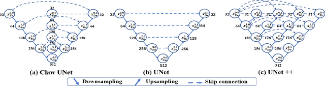 Figure 4 for Claw U-Net: A Unet-based Network with Deep Feature Concatenation for Scleral Blood Vessel Segmentation