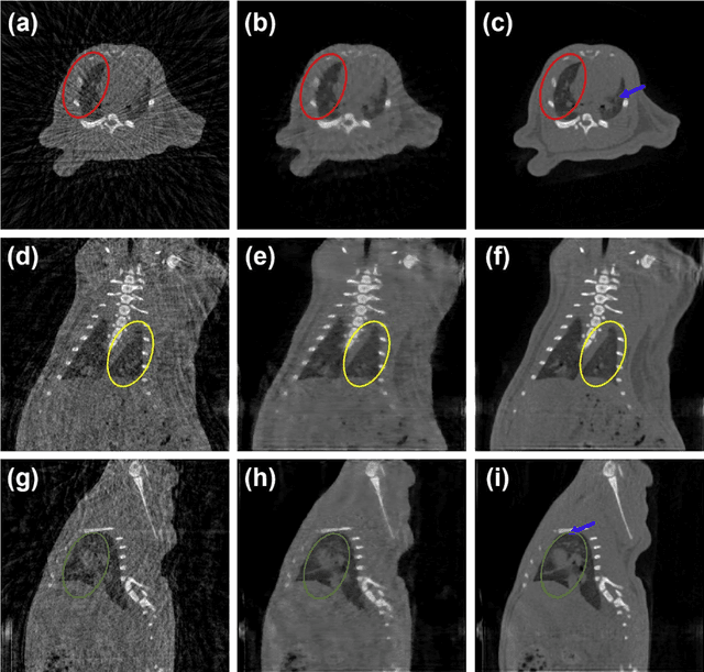 Figure 4 for Stationary Multi-source AI-powered Real-time Tomography for Dynamic Cardiac Imaging