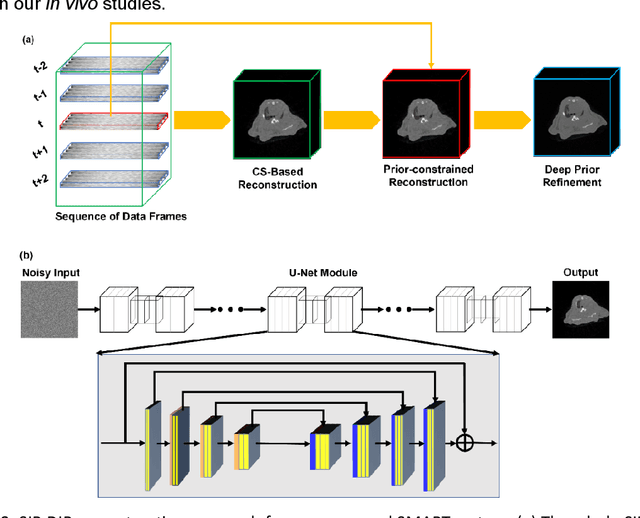 Figure 2 for Stationary Multi-source AI-powered Real-time Tomography for Dynamic Cardiac Imaging