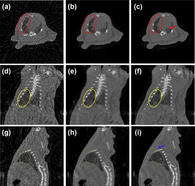 Figure 3 for Stationary Multi-source AI-powered Real-time Tomography for Dynamic Cardiac Imaging