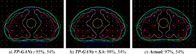 Figure 4 for Rapid treatment planning for low-dose-rate prostate brachytherapy with TP-GAN