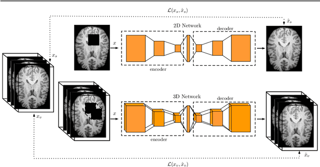 Figure 1 for 3-Dimensional Deep Learning with Spatial Erasing for Unsupervised Anomaly Segmentation in Brain MRI