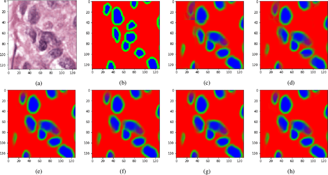 Figure 4 for Introducing Hann windows for reducing edge-effects in patch-based image segmentation